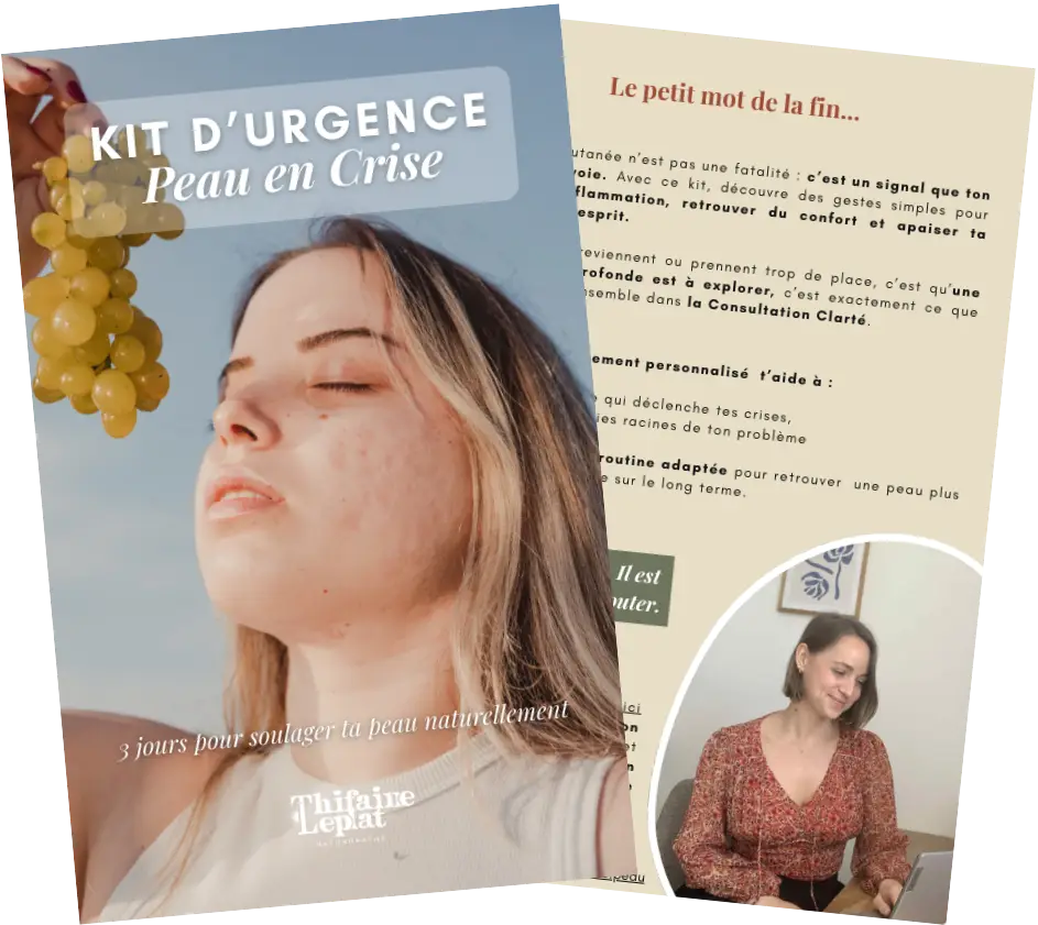 apaiser crise d'acné